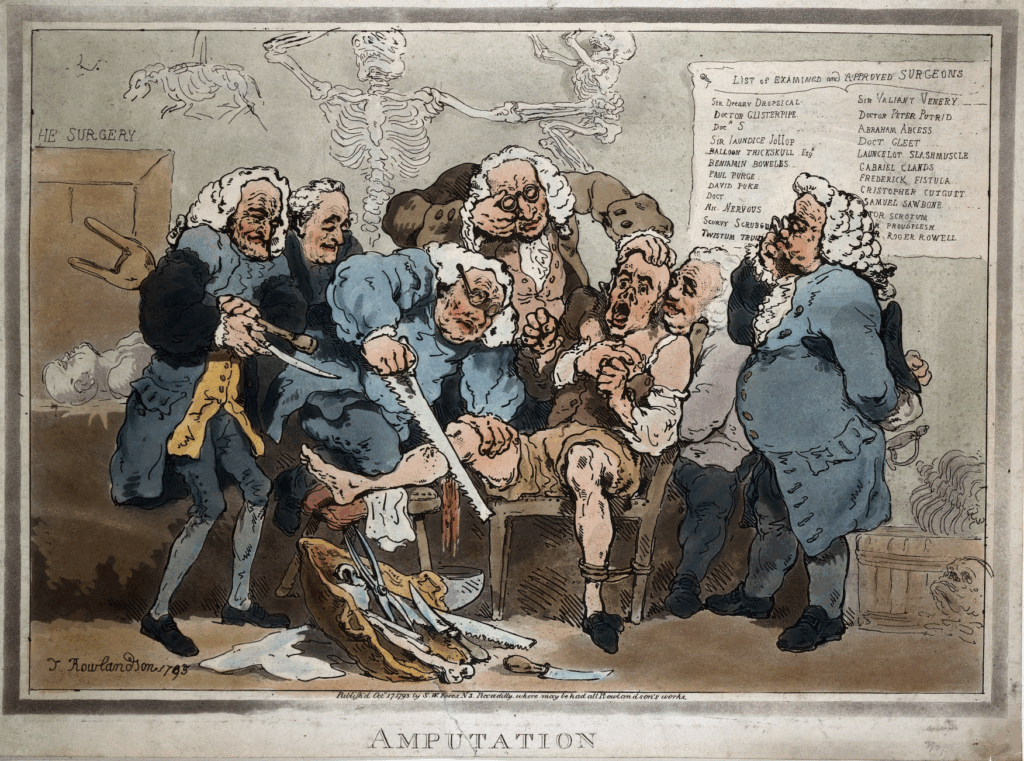 Thomas Rowlandson, Amputation (1793). In the foreground, doctors amputate a healthy limb, without anesthetic, despite the protests of the patient. In the background, the specter of death hovers over a cadaver, showing what becomes of victims of haphazard surgery.